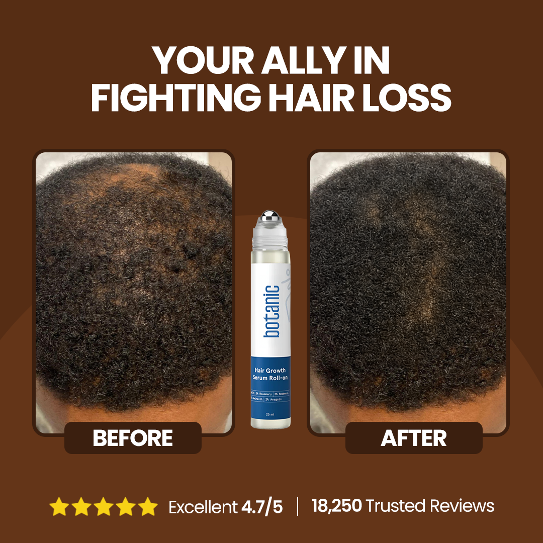 Patented Rosemary Hair Growth Roll-On Serum