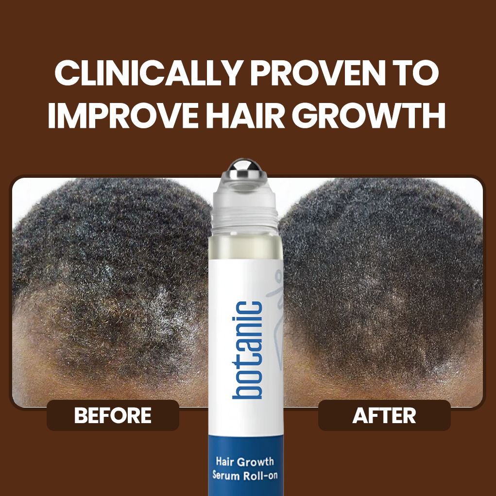 Patented Rosemary Hair Growth Roll-On Serum